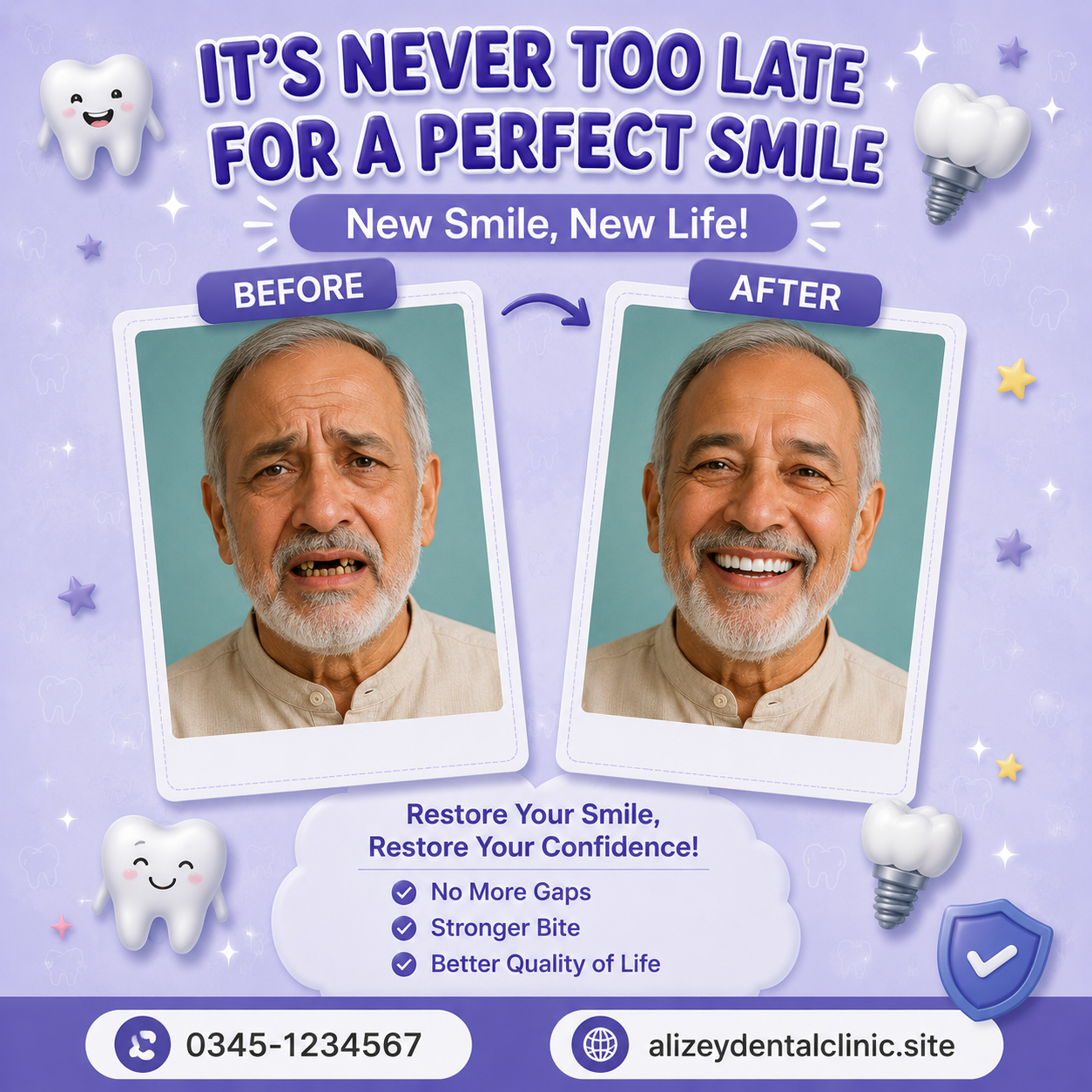 Adult Smile Transformation – Before and After at Alizey Dental Clinic