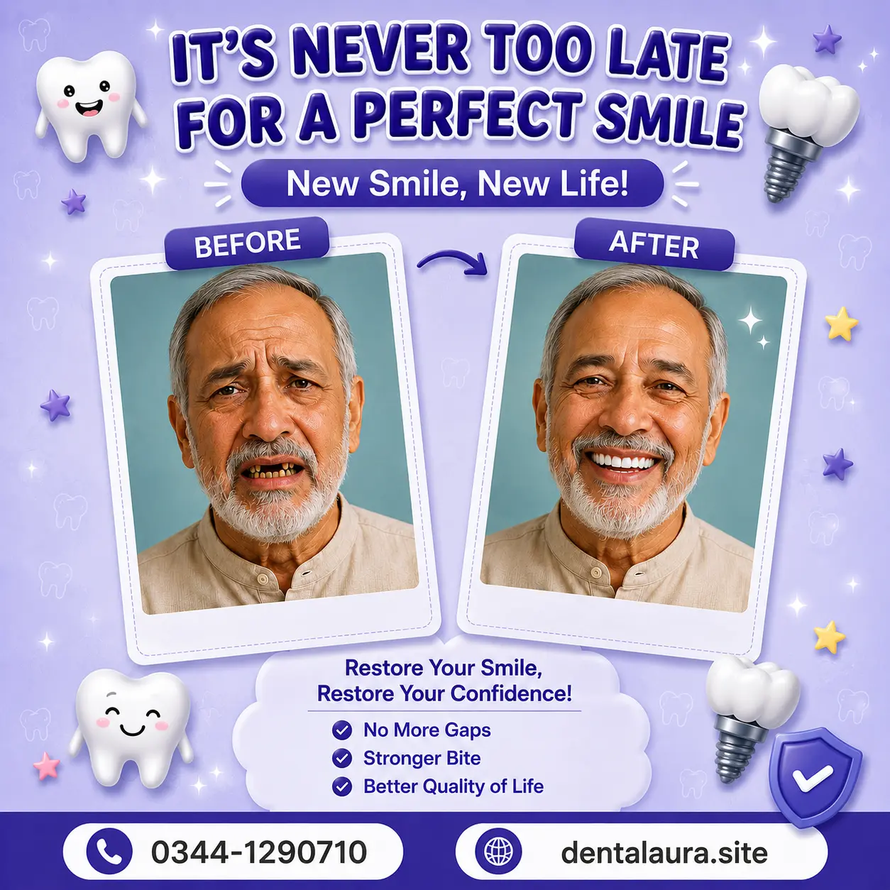 Adult Smile Transformation – Before and After at Dental Aura